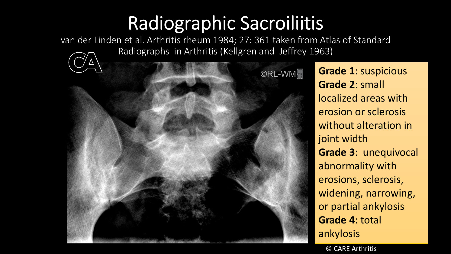 Grading Examples Slide